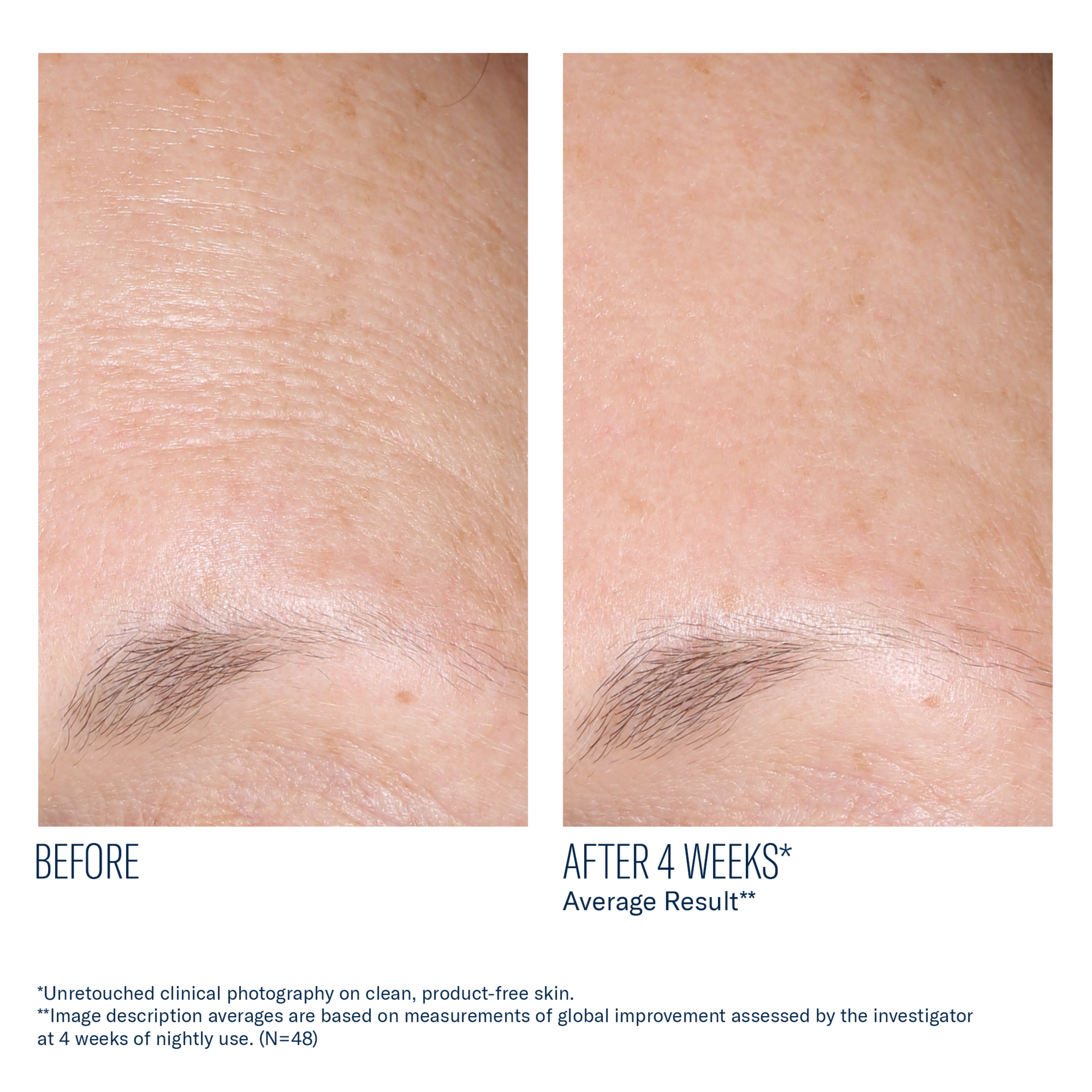 Before and after comparison of skin treatment showing improvement over 4 weeks.