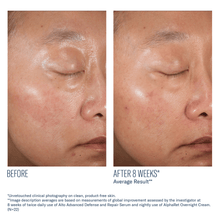 Load image into Gallery viewer, Skinbetter Science A-Team Duo Kit