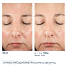 Load image into Gallery viewer, Skinbetter Science BioRewind Skin Health Dietary Supplement