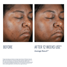 Load image into Gallery viewer, Skinbetter Science Even Intensive Skin Tone Correcting Serum