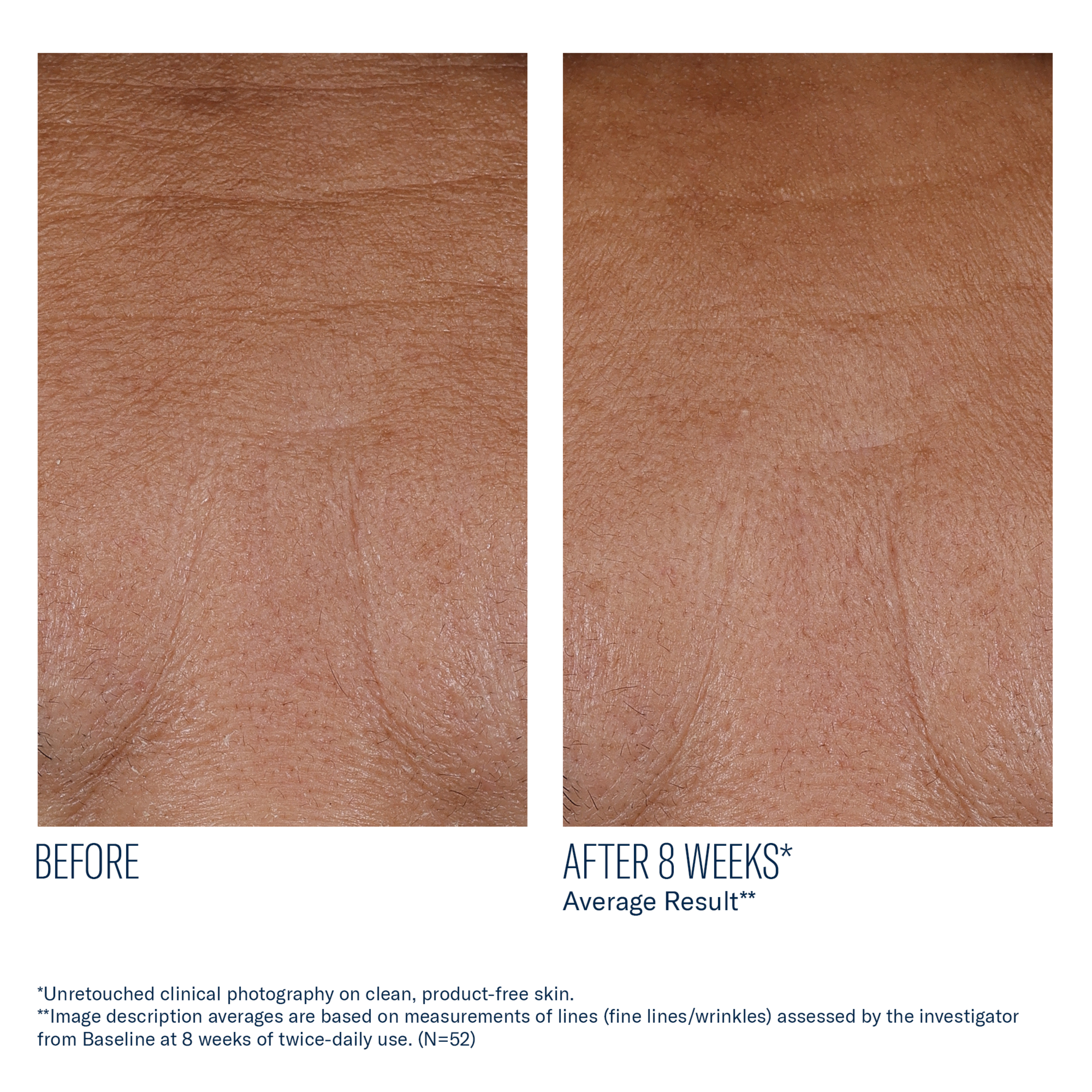 Before and after comparison of skin texture with text indicating results after 8 weeks.