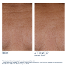 Load image into Gallery viewer, Skinbetter Science InterFuse Treatment Cream Face & Neck, 30mL