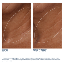 Load image into Gallery viewer, Skinbetter Science Techno Neck Perfecting Cream