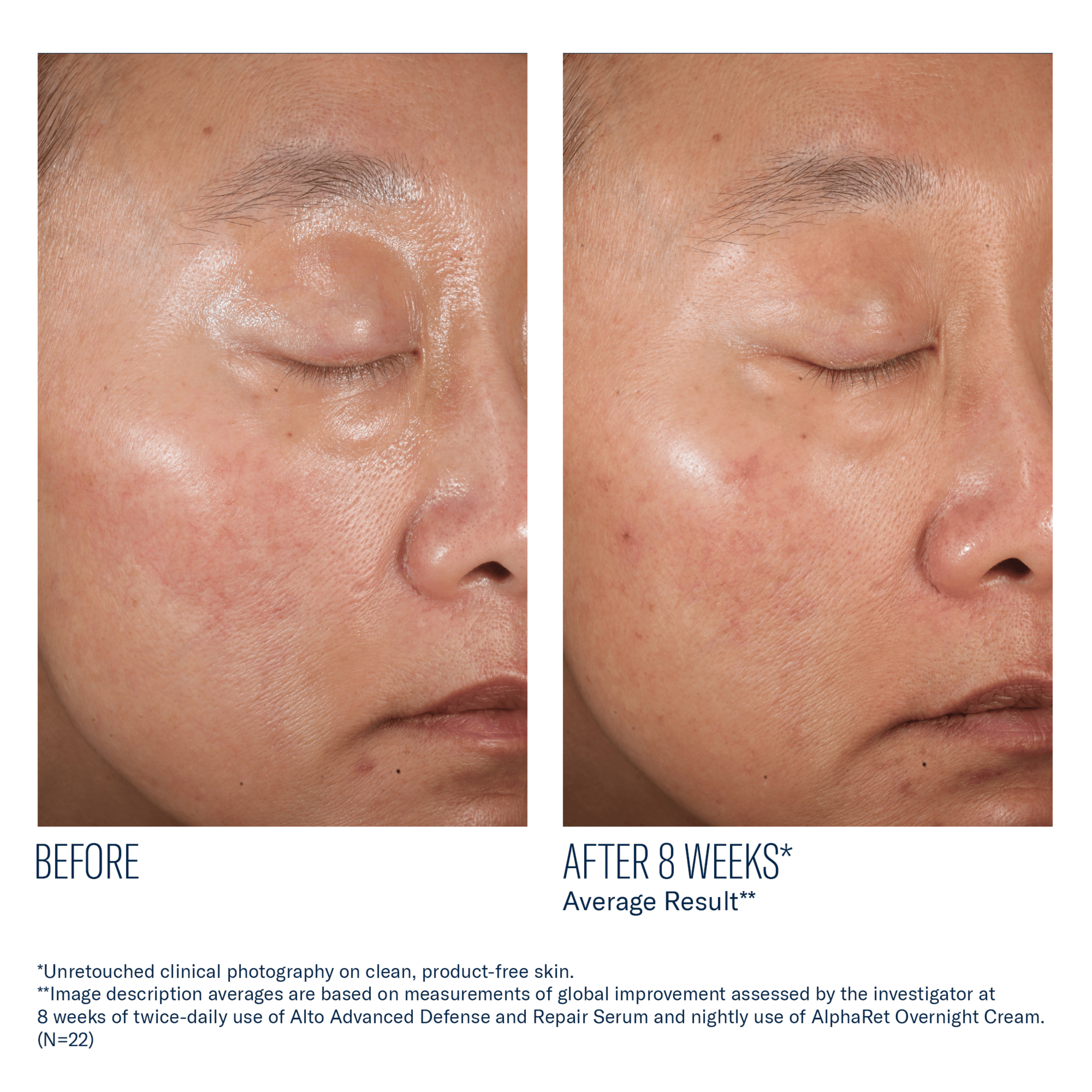 Before and after comparison of a person's face, showing improvement after 8 weeks.