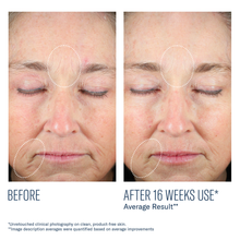Load image into Gallery viewer, Skinbetter Science Mystro Revive Renewing Serum
