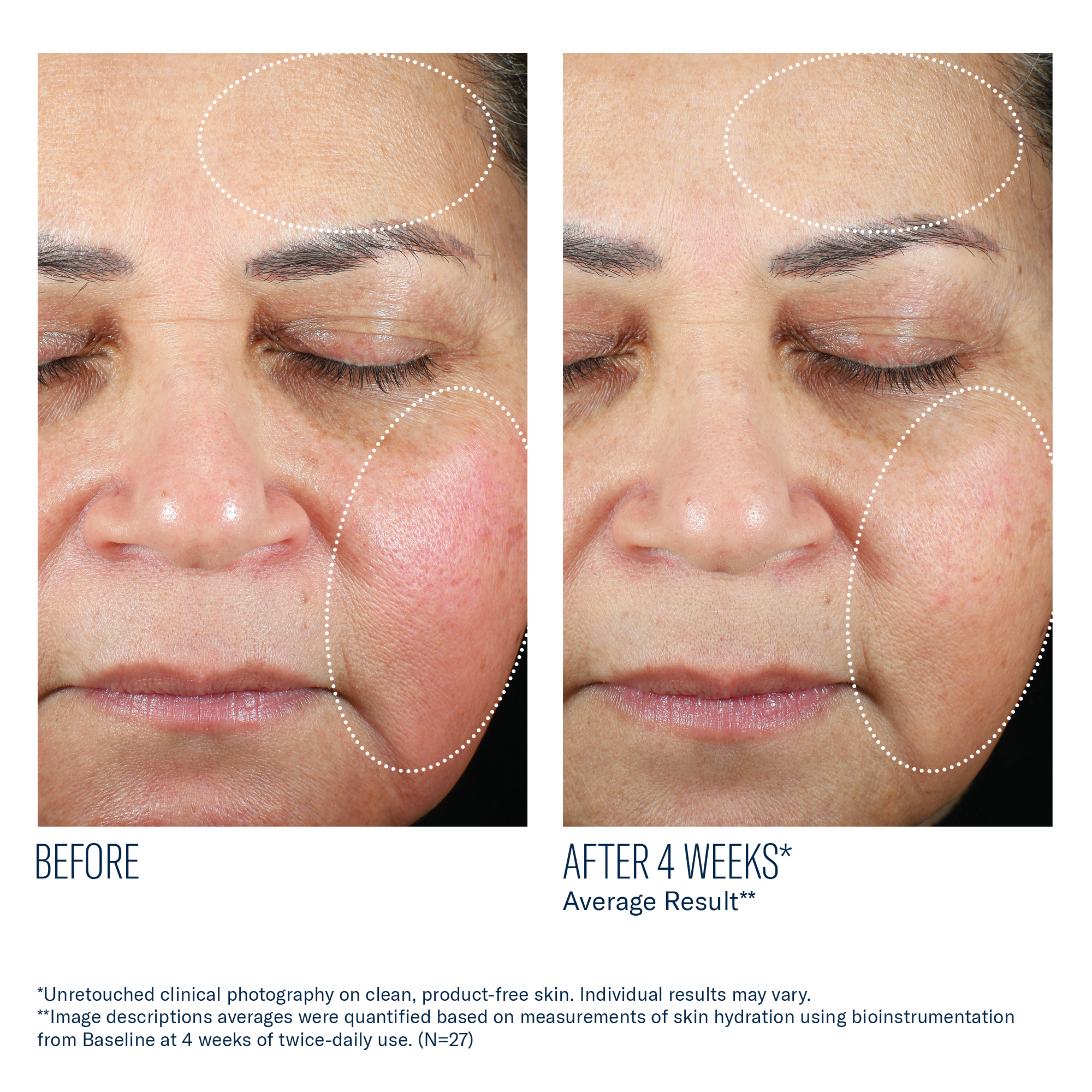 Skinbetter Science Trio Luxe Moisture Treatment