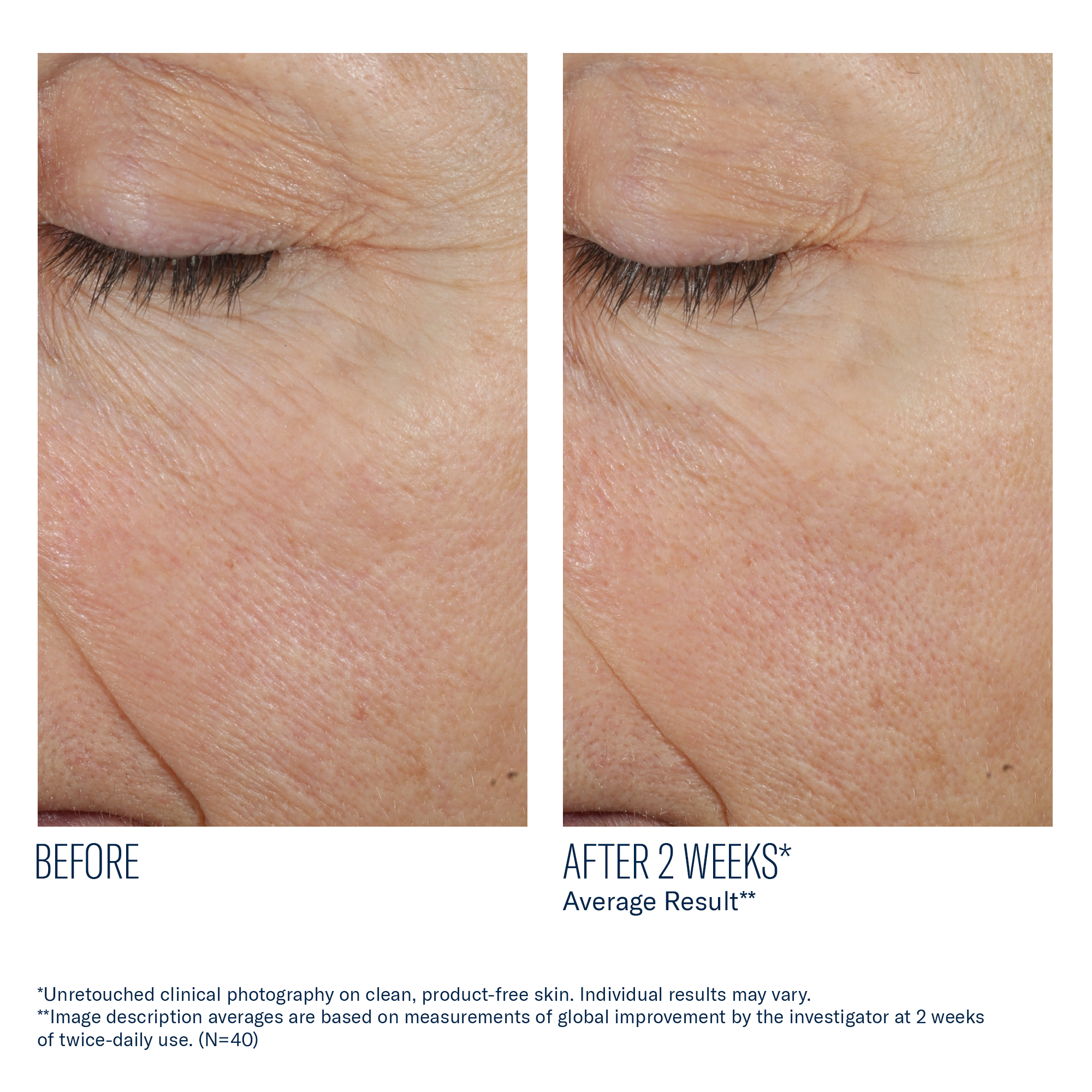 Before and after comparison of eye skin texture with text indicating result after 2 weeks.