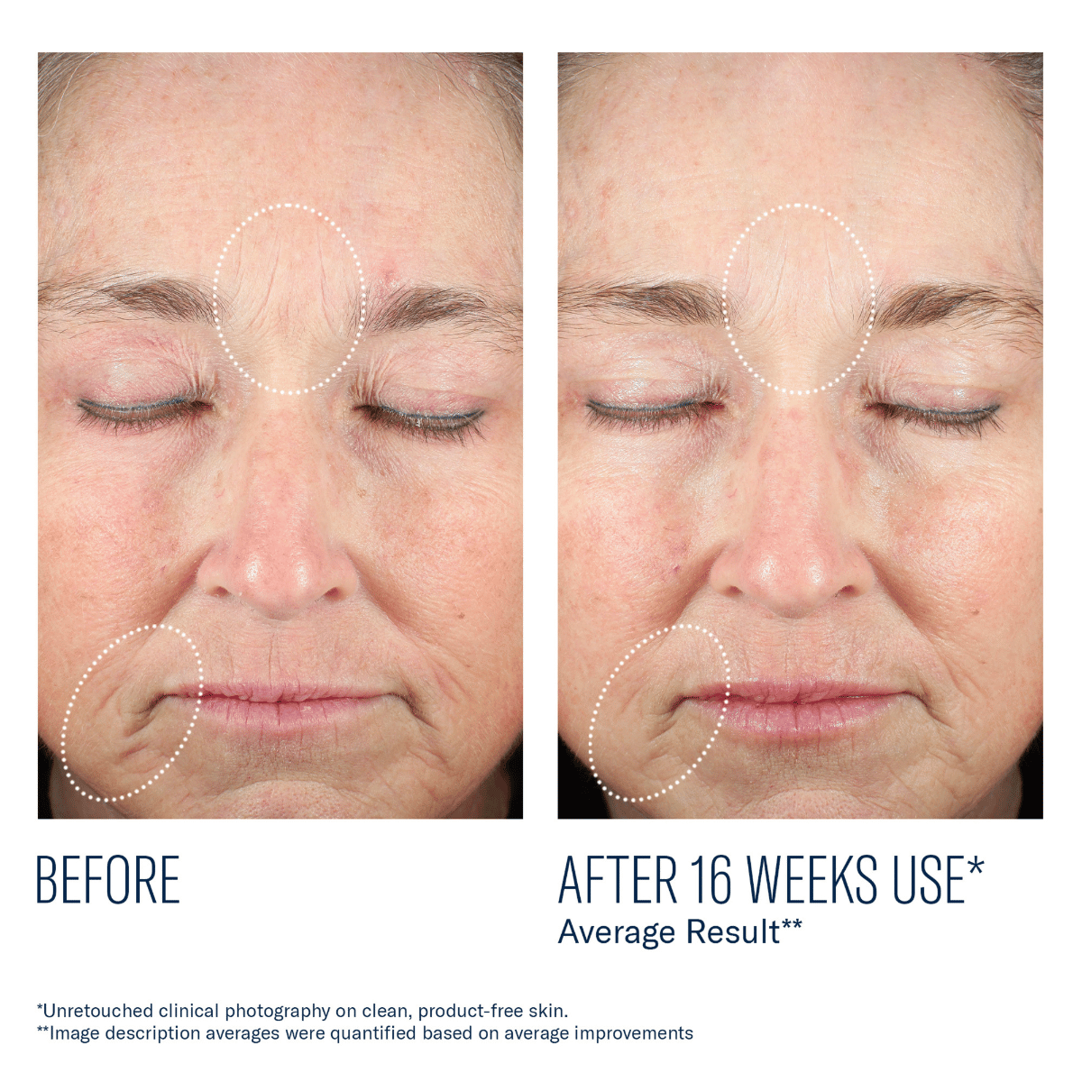 Skinbetter Science Mystro Revive Renewing Serum